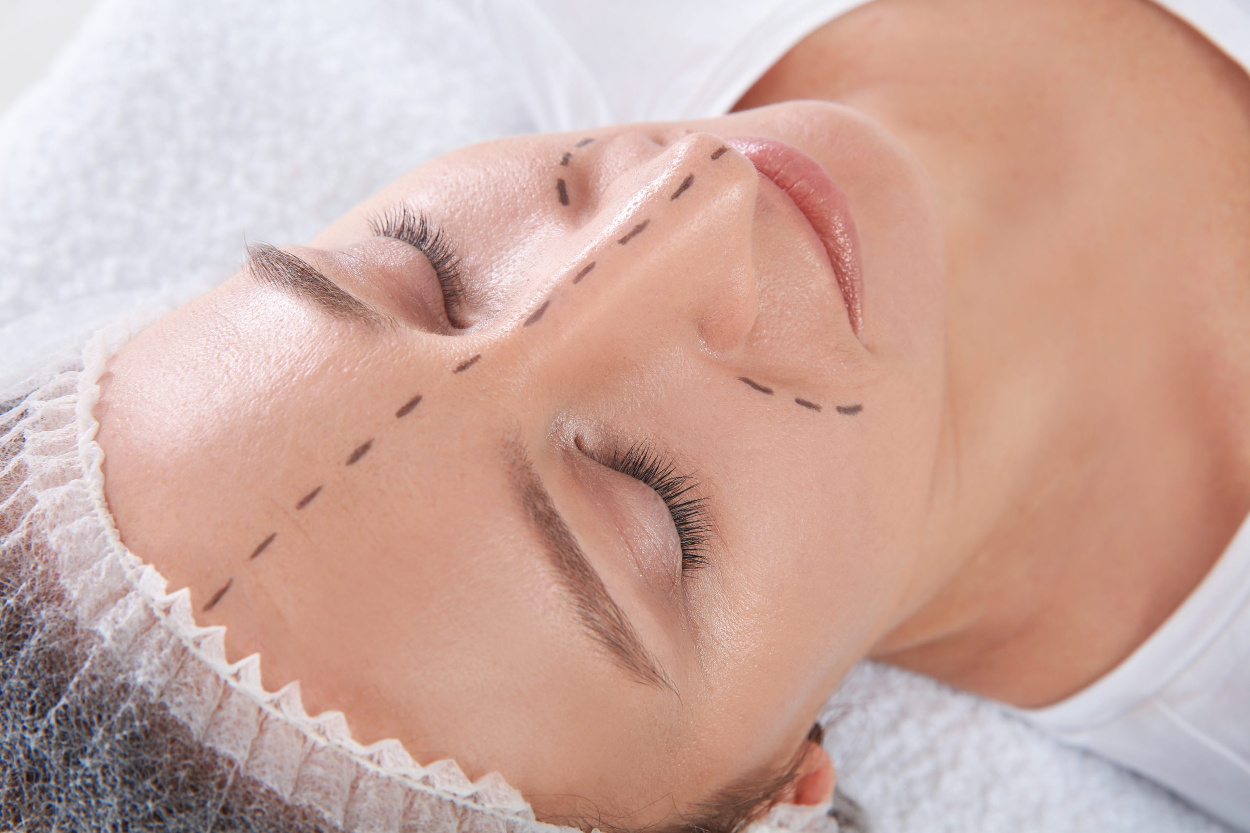 Patient preparing for a cosmetic procedure
