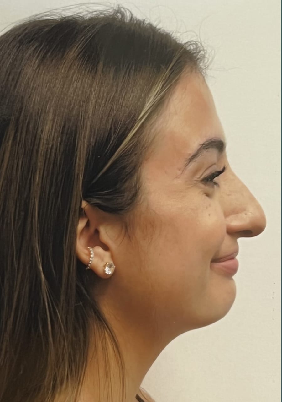 Case Study 83 — before and after