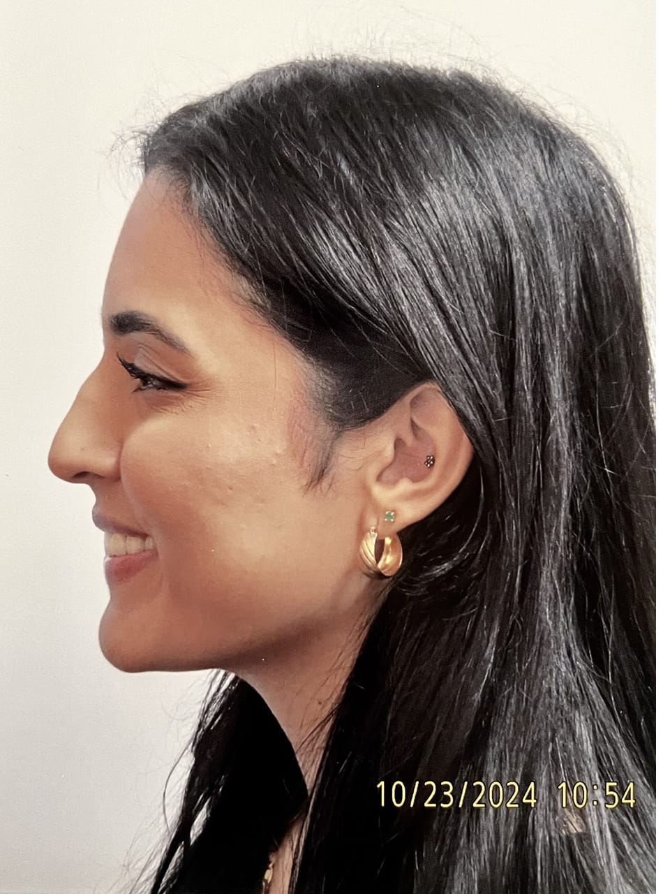 Case Study 244 — before and after