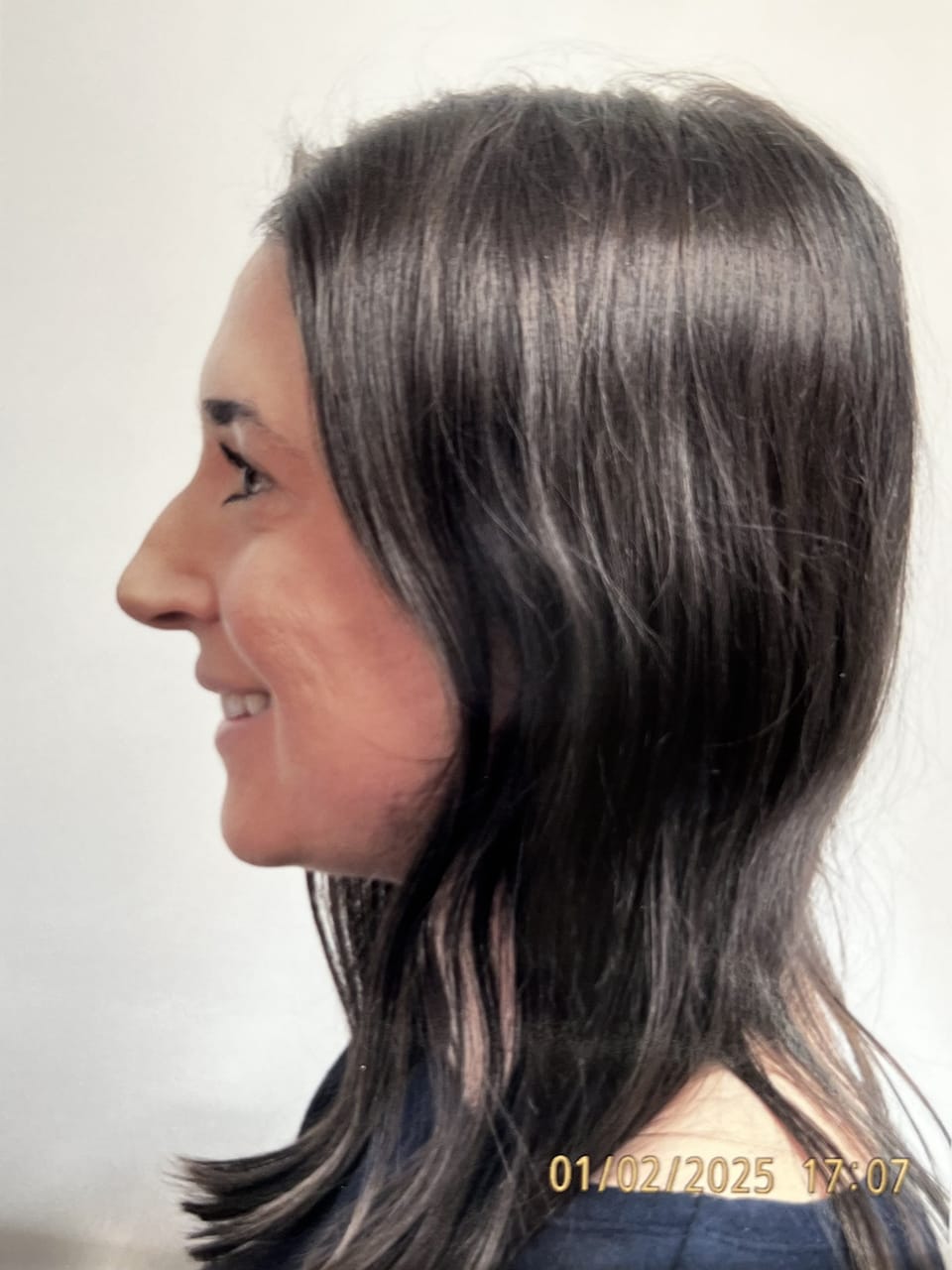 Case Study 261 — before and after