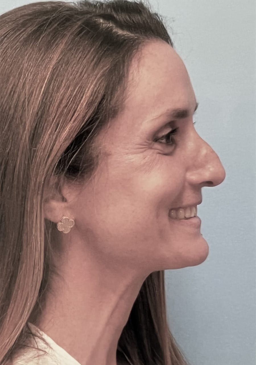 Case Study 99 — before and after