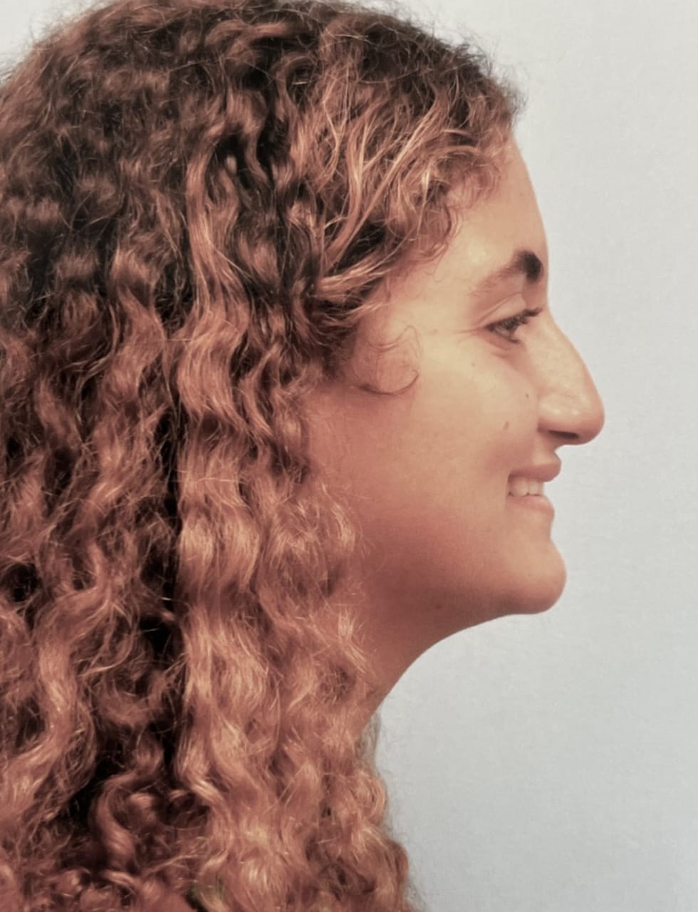 Case Study 62 — before and after