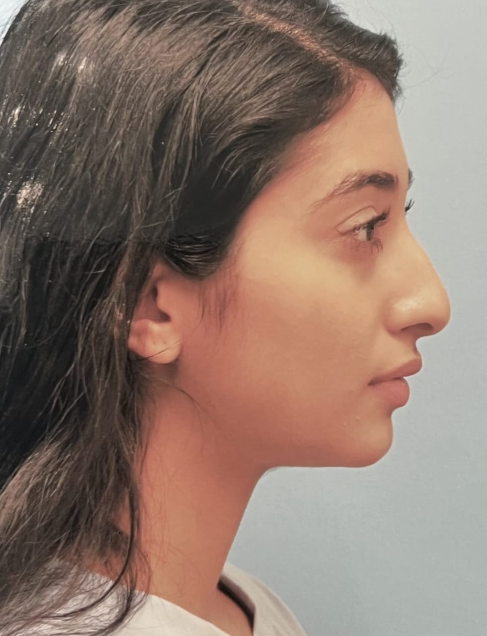Case Study 70 — before and after