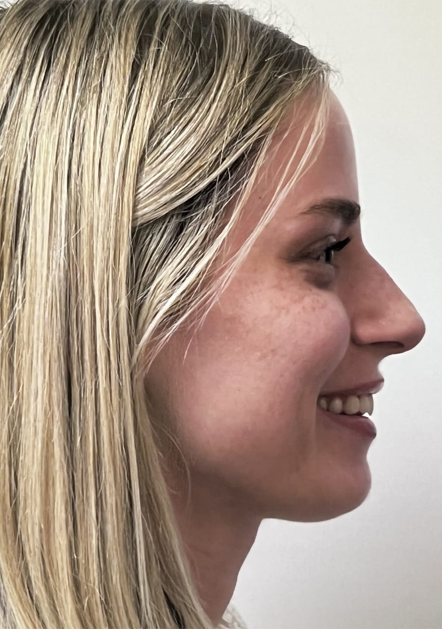 Case Study 93 — before and after