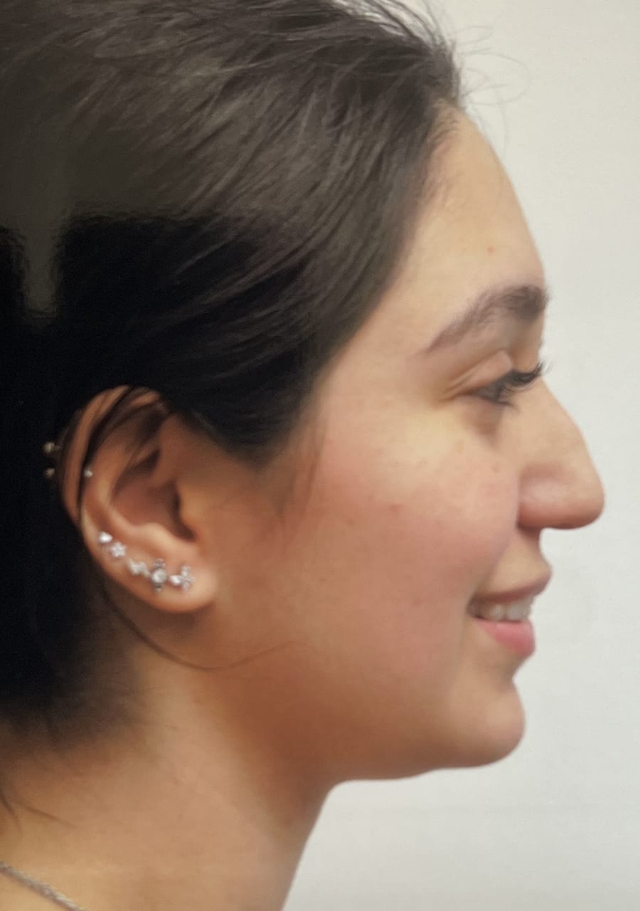 Case Study 104 — before and after