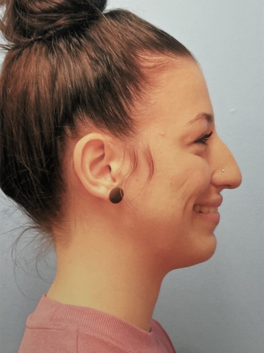 Case Study 79 before
