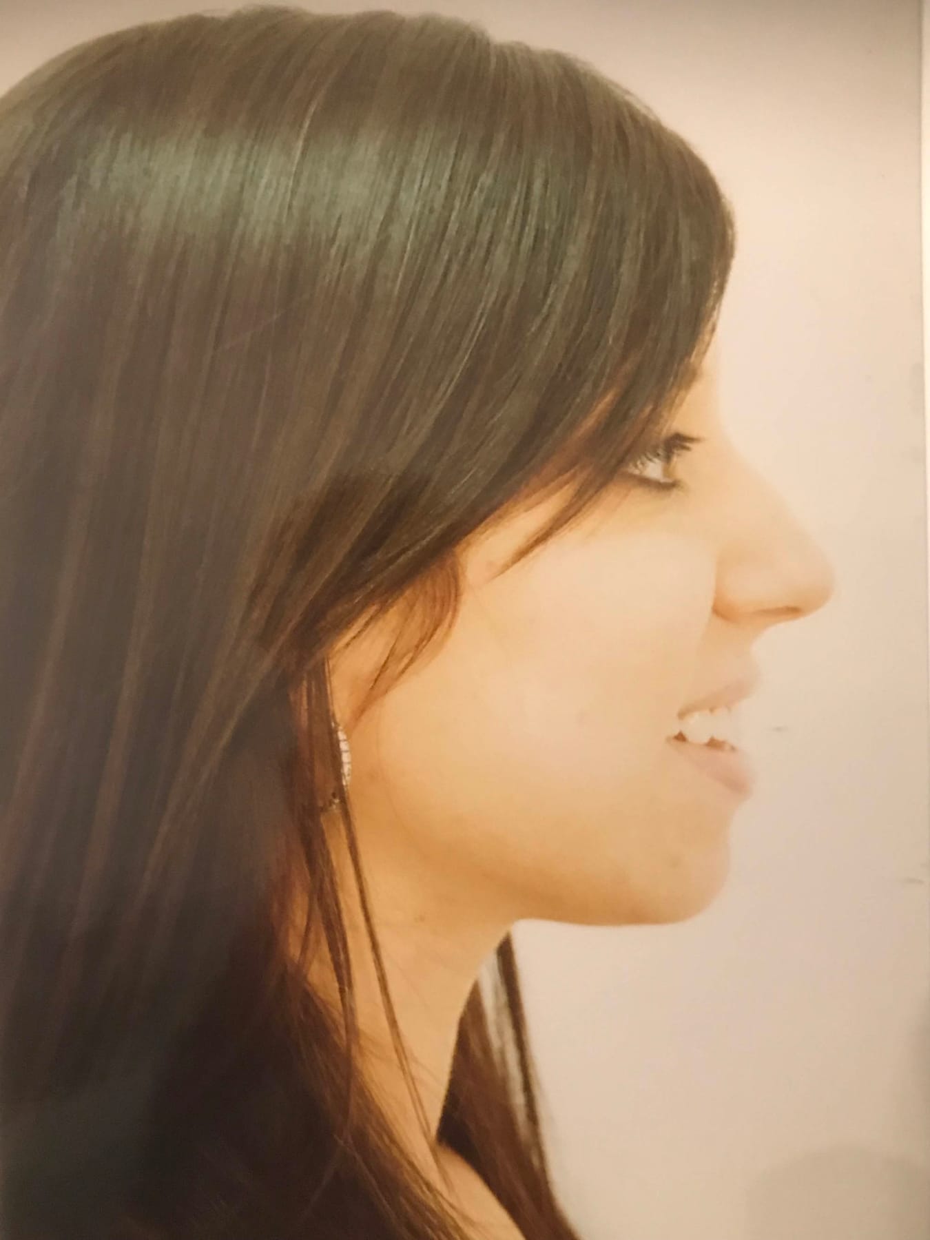 Case Study 31 — before and after