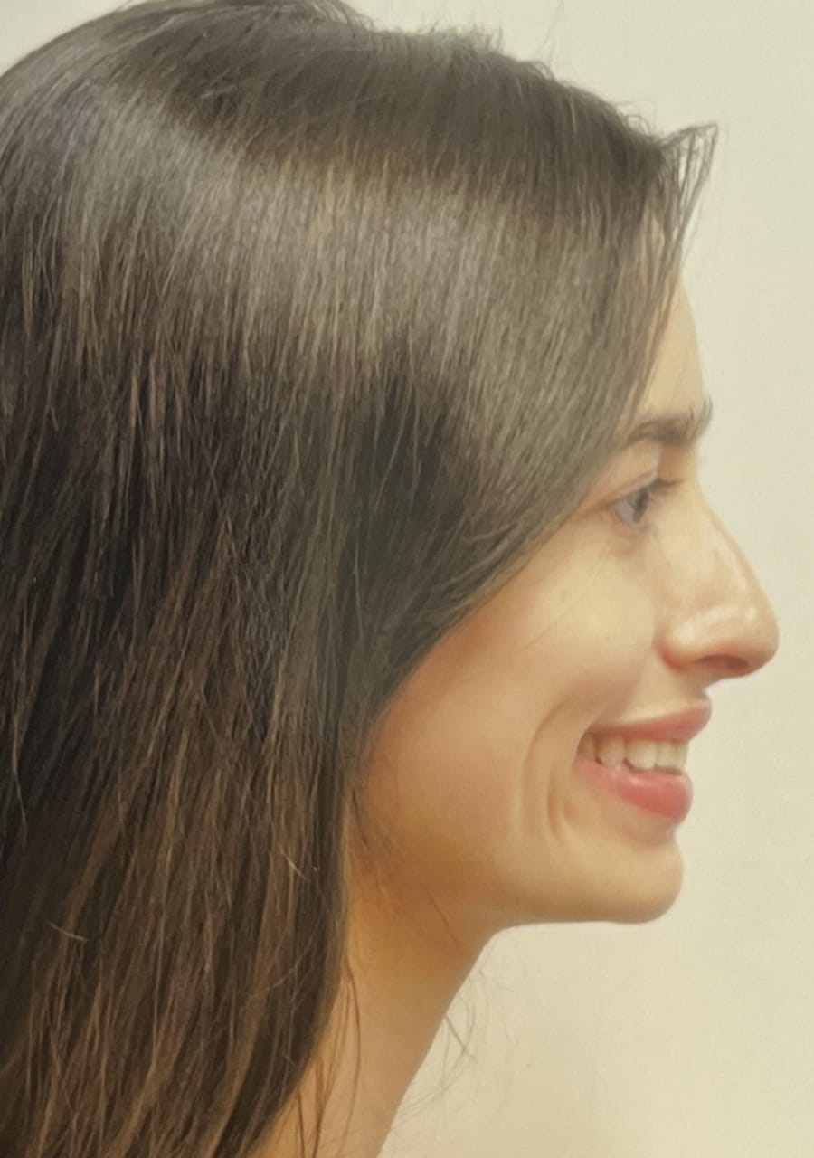 Case Study 84 — before and after