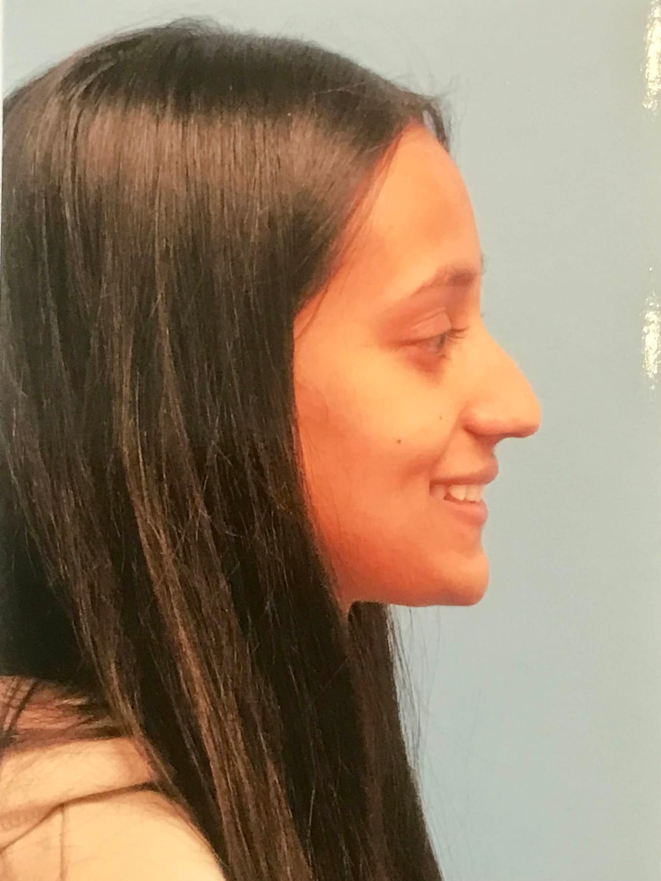 Case Study 29 — before and after