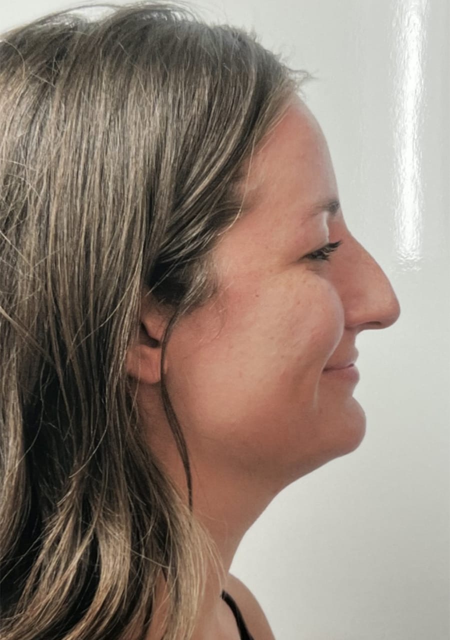 Case Study 82 before