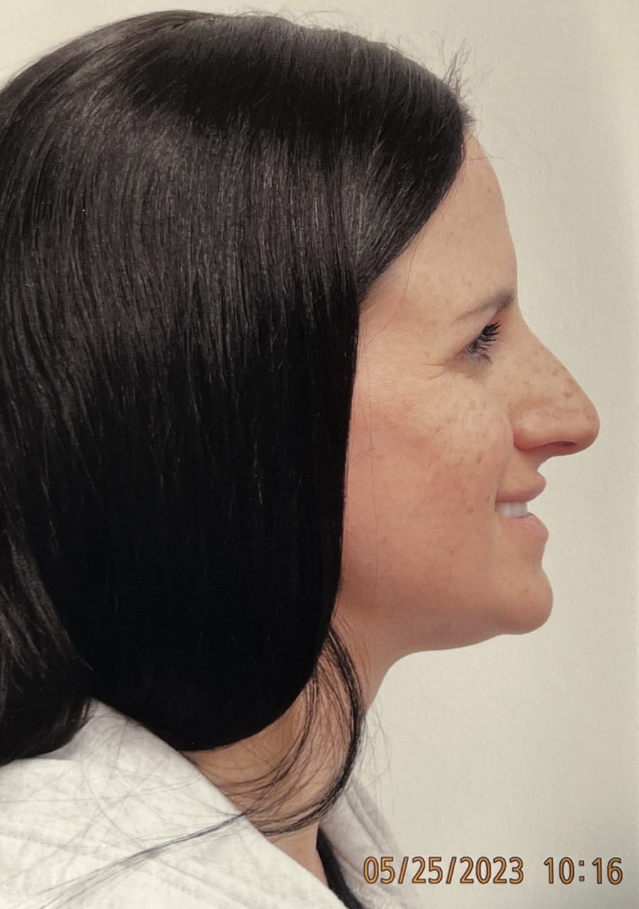Case Study 145 — before and after
