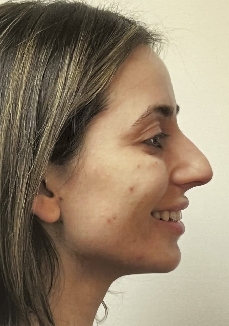 Case Study 105 — before and after