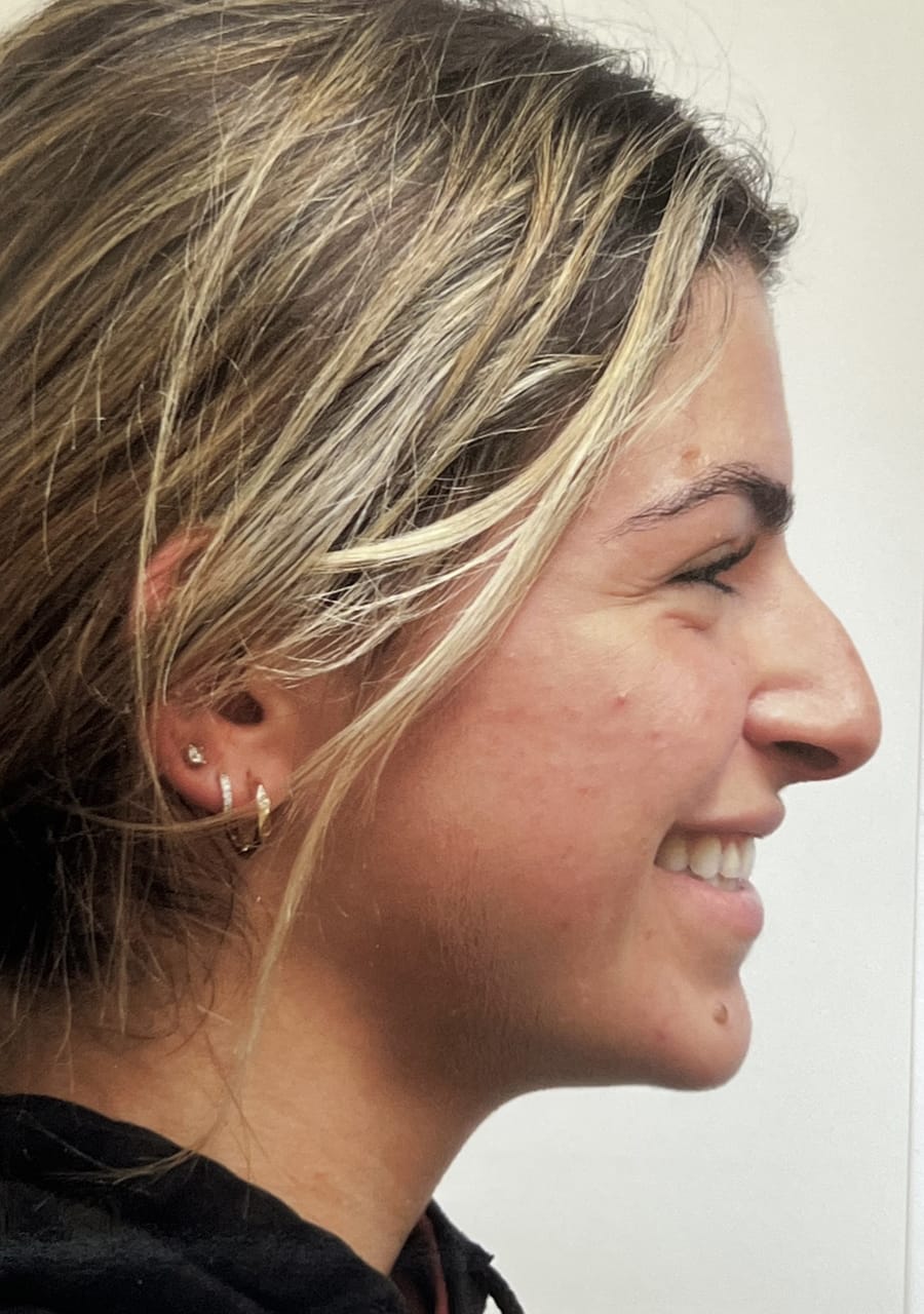 Case Study 107 — before and after