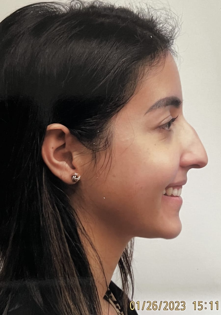 Case Study 128 — before and after