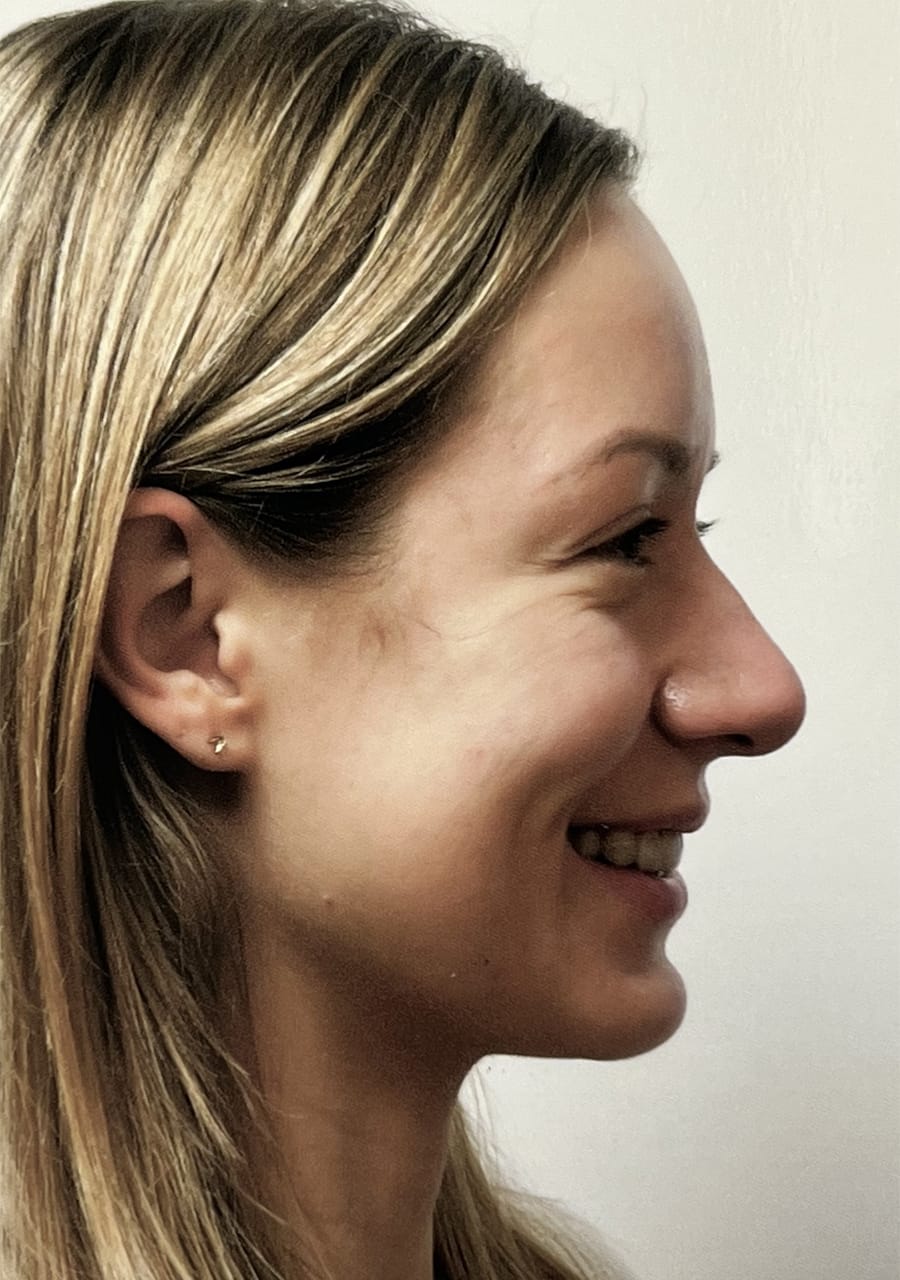 Case Study 111 — before and after