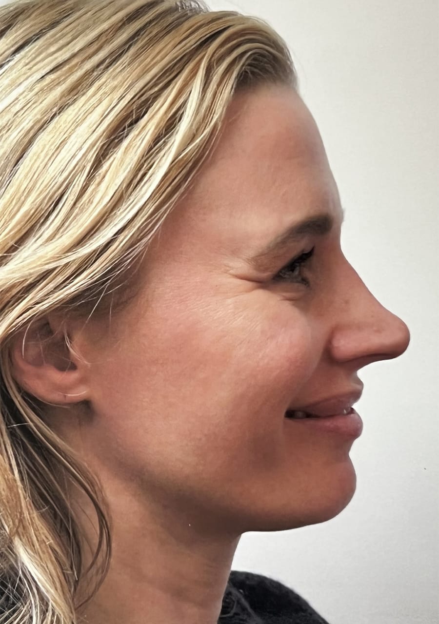 Case Study 118 — before and after