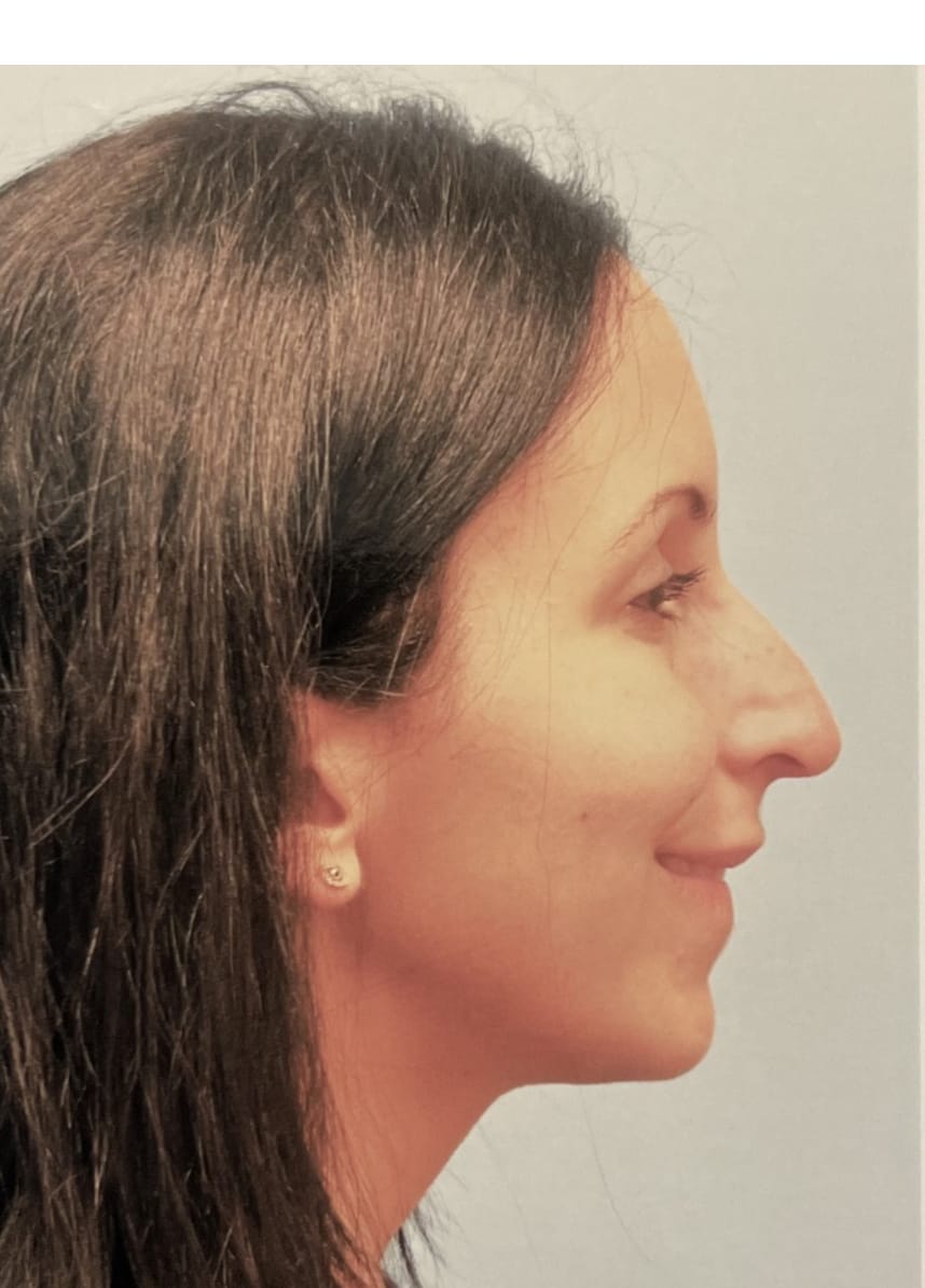 Case Study 64 — before and after
