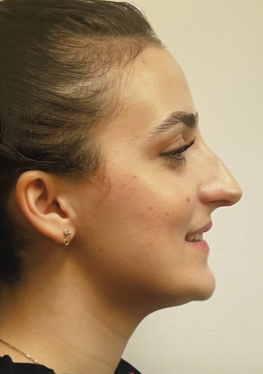 Case Study 106 — before and after