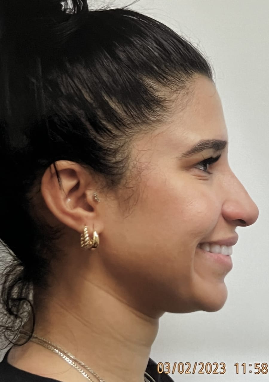 Case Study 129 — before and after