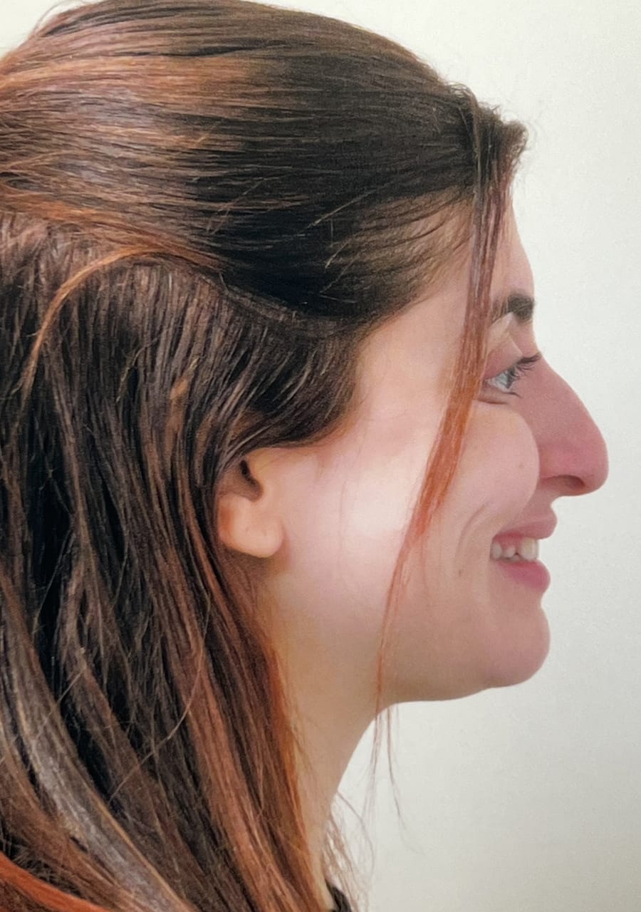 Case Study 147 — before and after