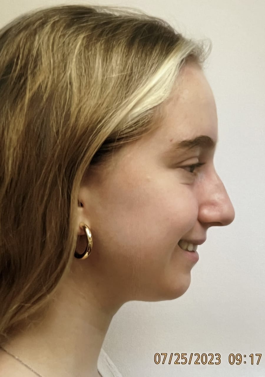 Case Study 124 — before and after