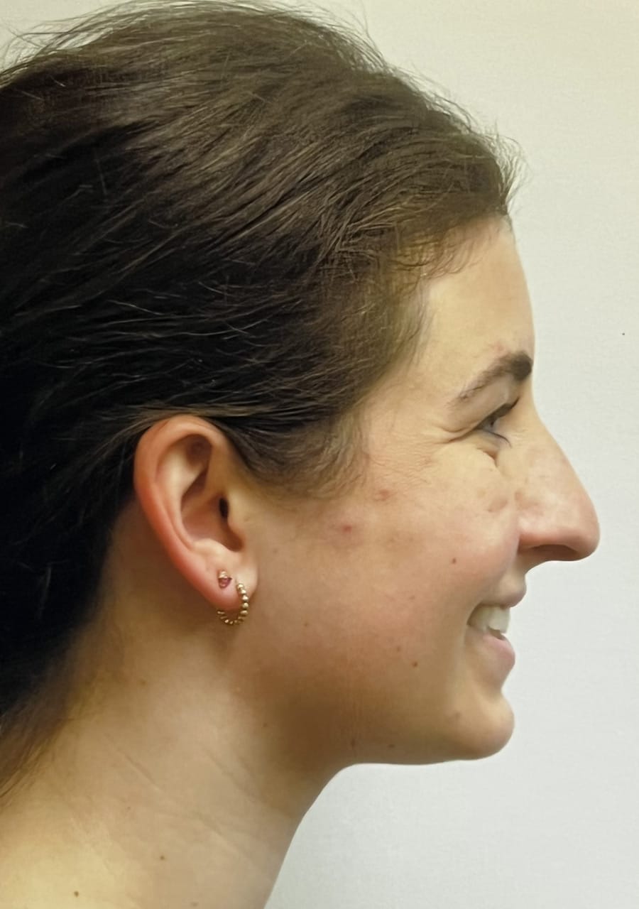 Case Study 97 — before and after