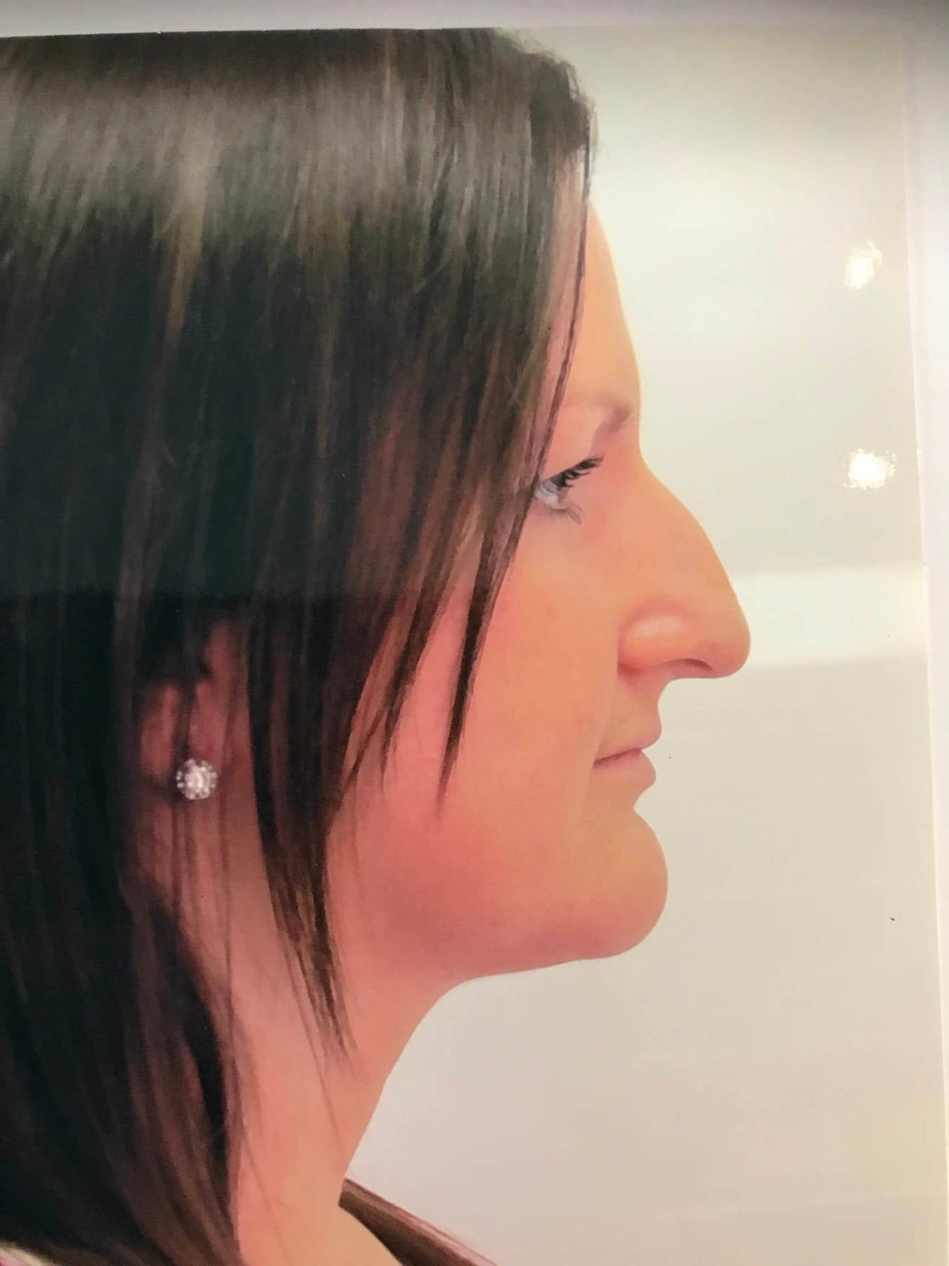 Case Study 39 — before and after