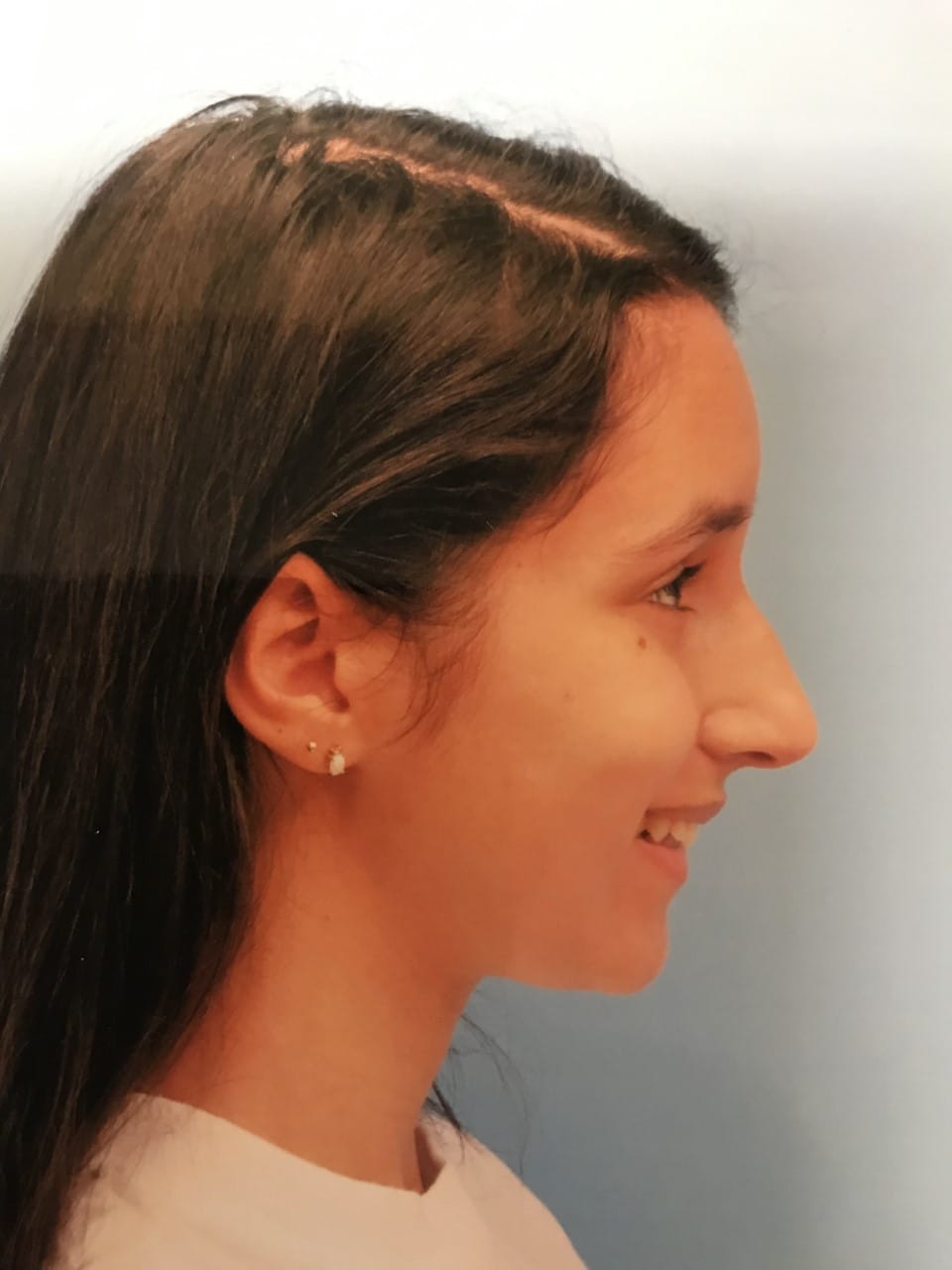 Case Study 18 — before and after