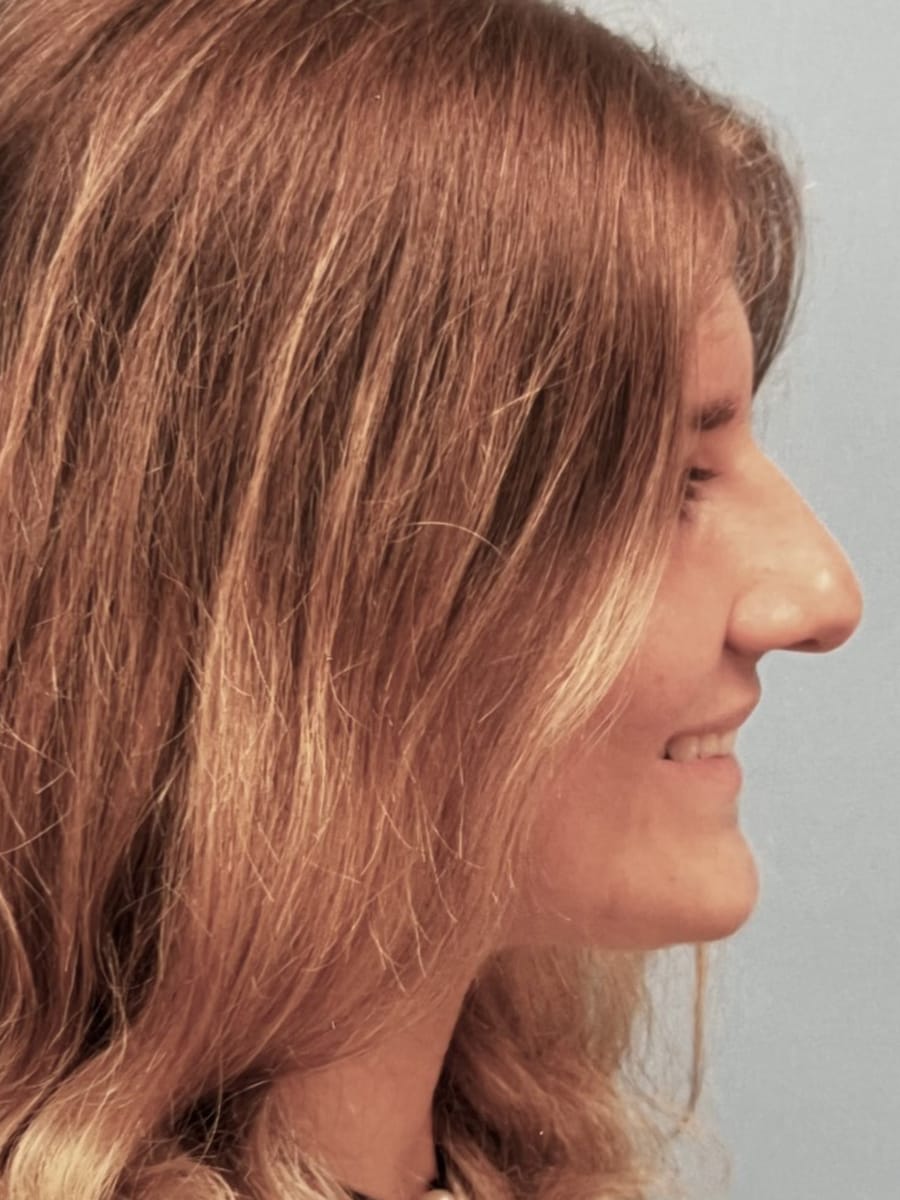 Case Study 66 — before and after