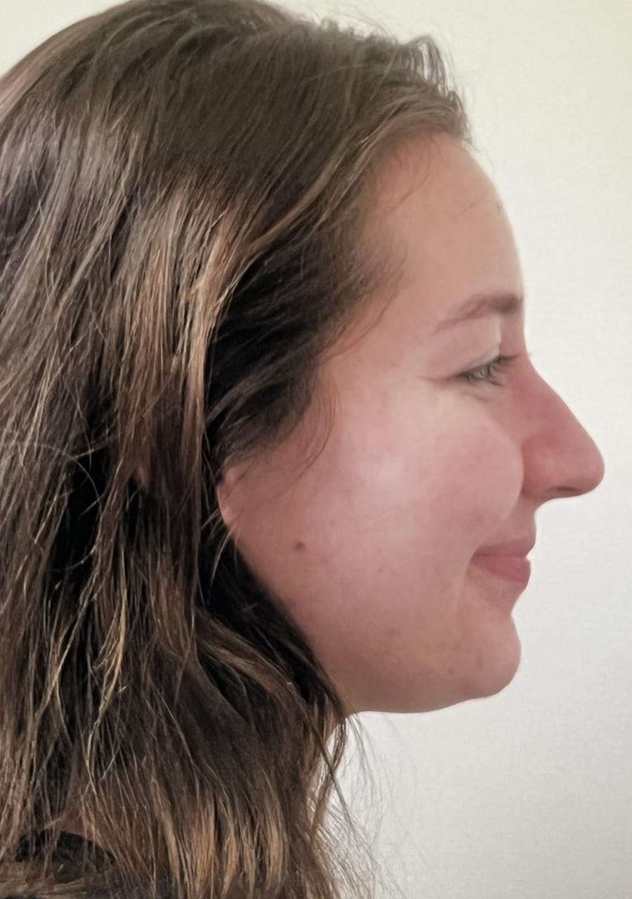 Case Study 103 — before and after