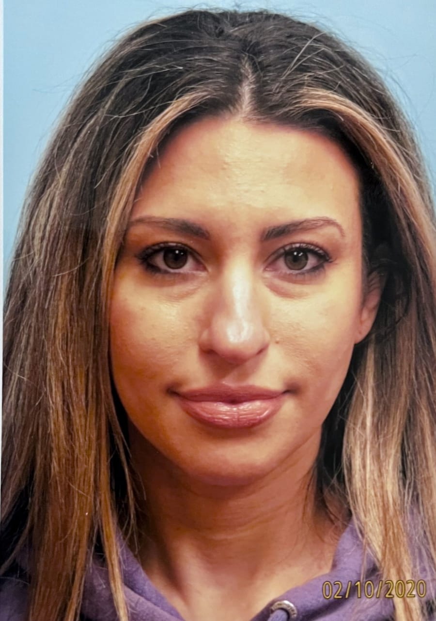 Case Study 49 — before and after