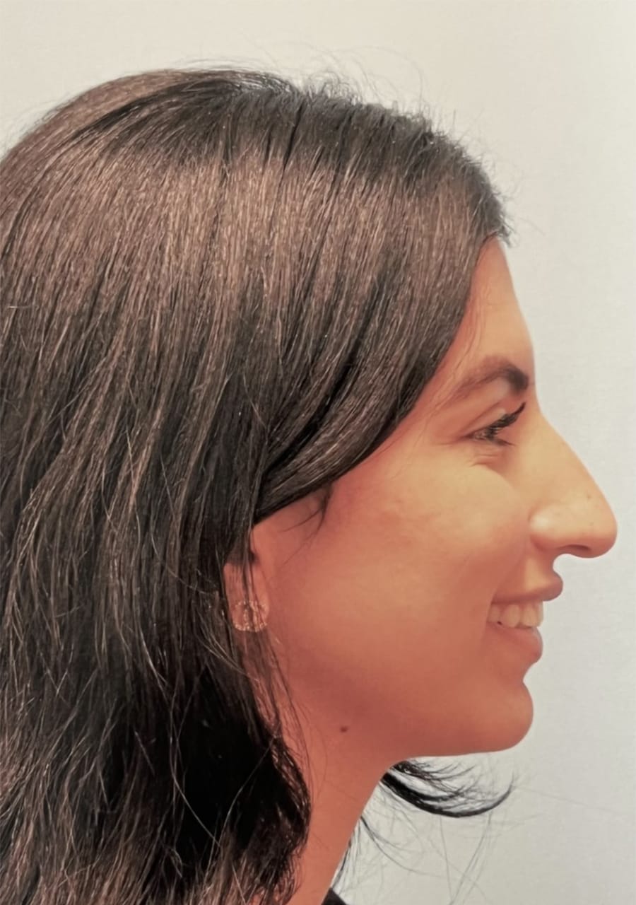 Case Study 69 — before and after