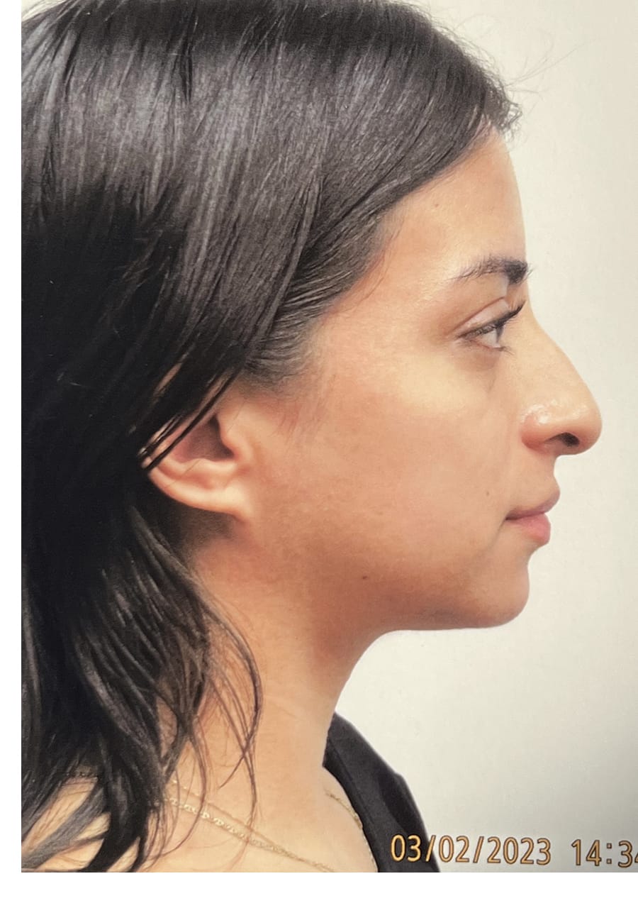 Case Study 146 — before and after