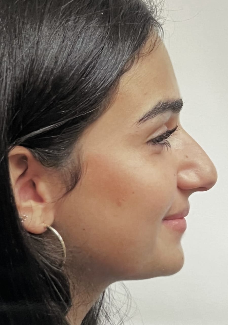 Case Study 110 — before and after