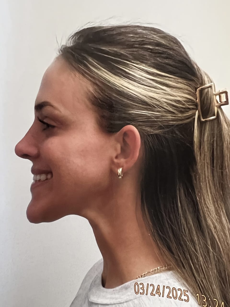 Case Study 259 — before and after