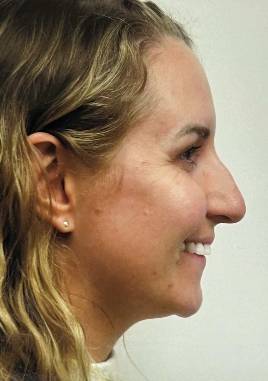 Case Study 117 — before and after