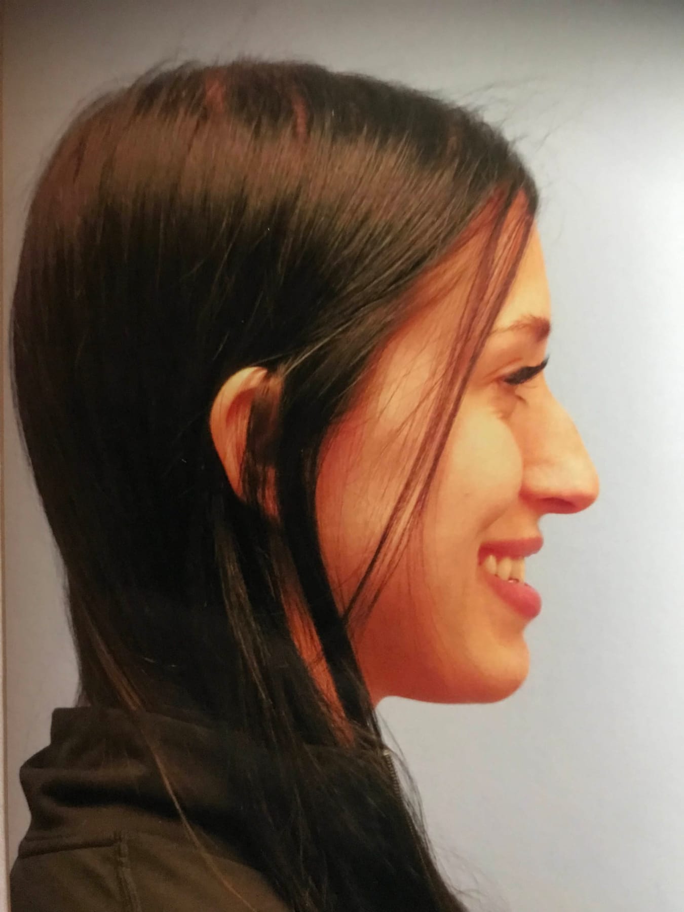 Case Study 2 — before and after