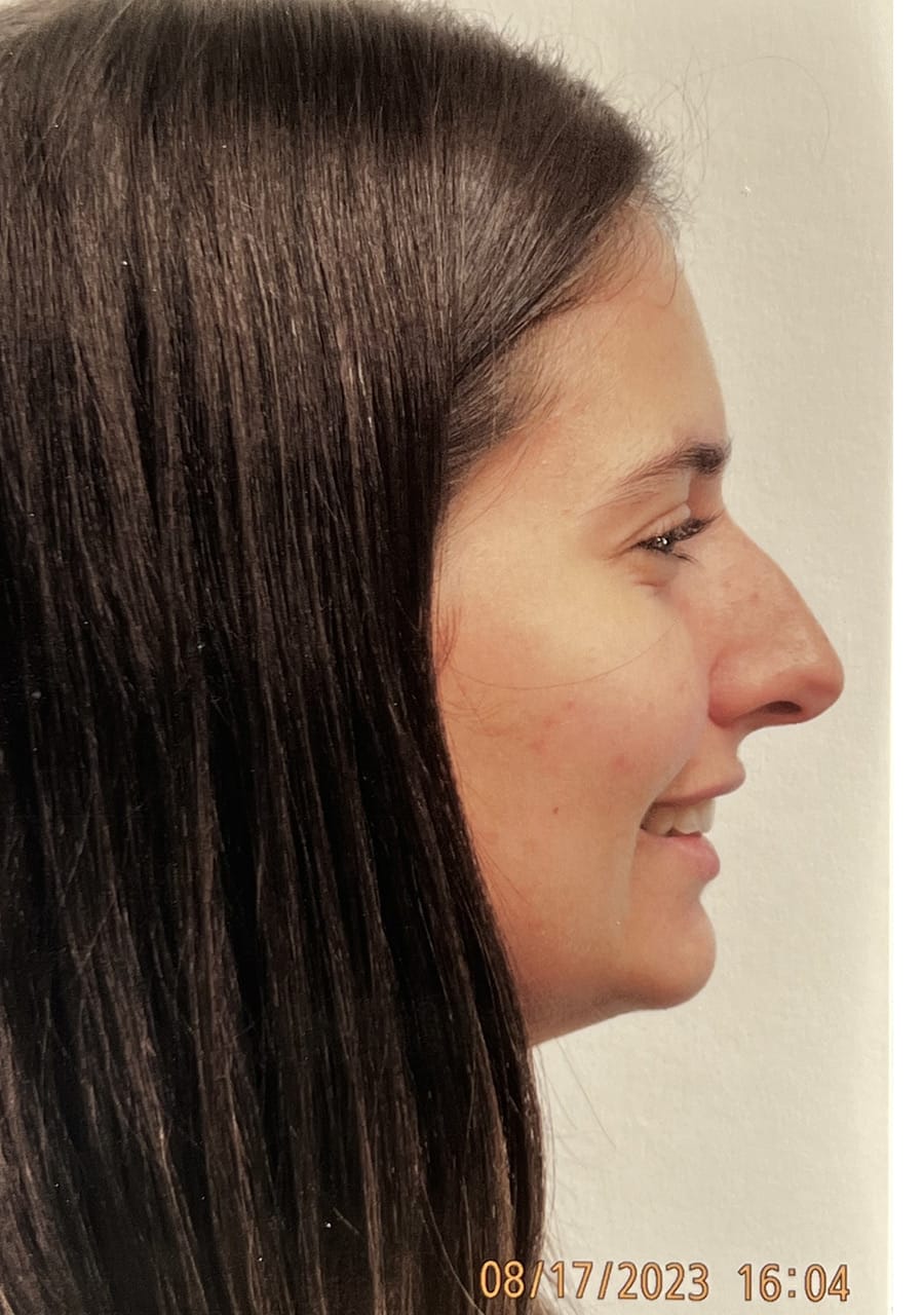 Case Study 142 — before and after