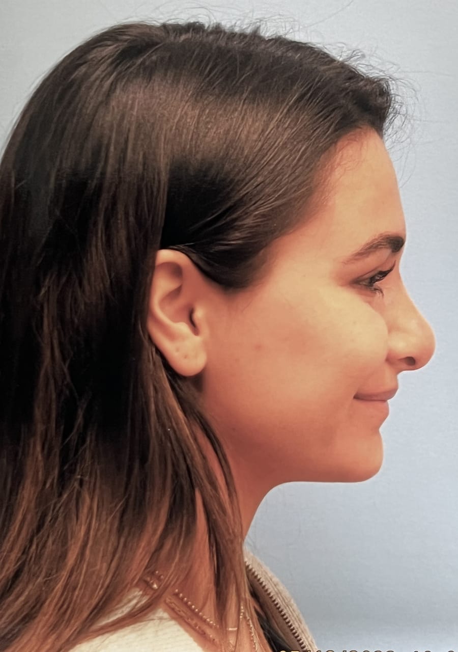 Case Study 131 — before and after