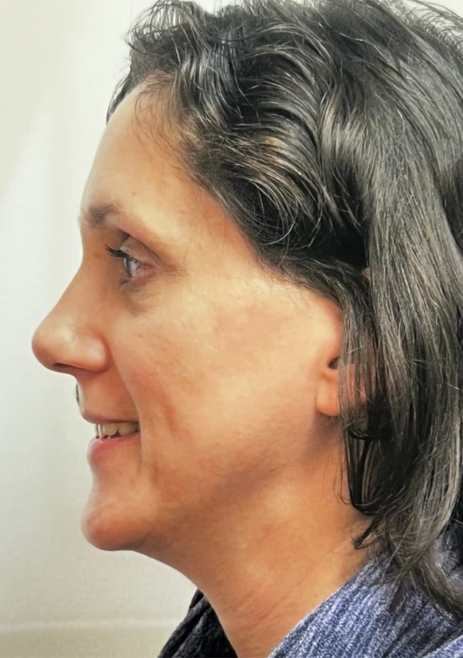 Case Study 86 after