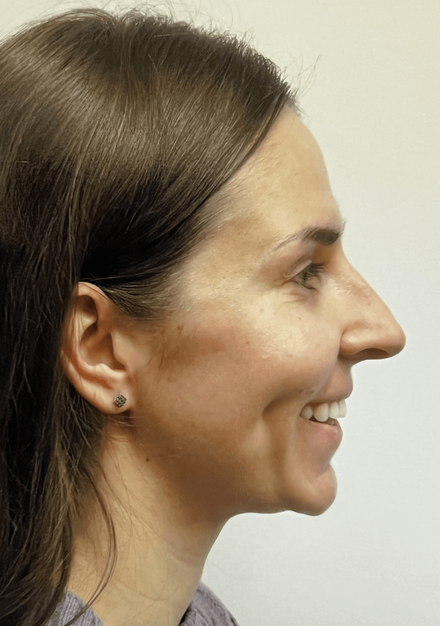 Case Study 94 — before and after