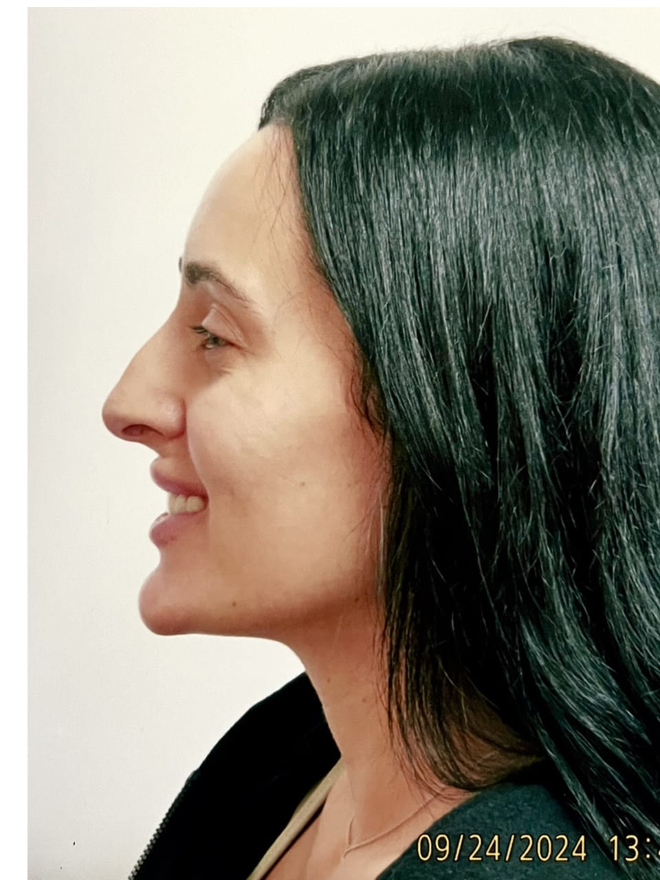 Case Study 239 — before and after