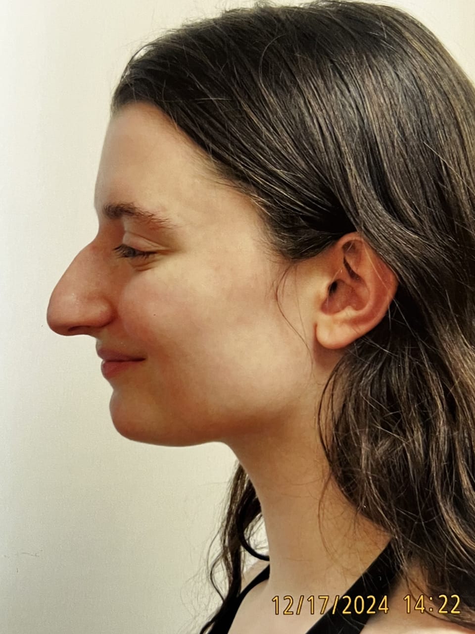 Case Study 256 — before and after