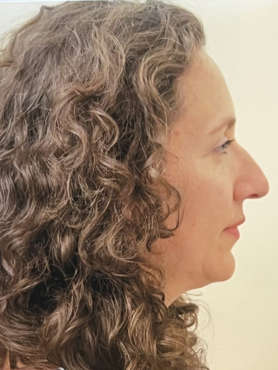 Case Study 77 — before and after