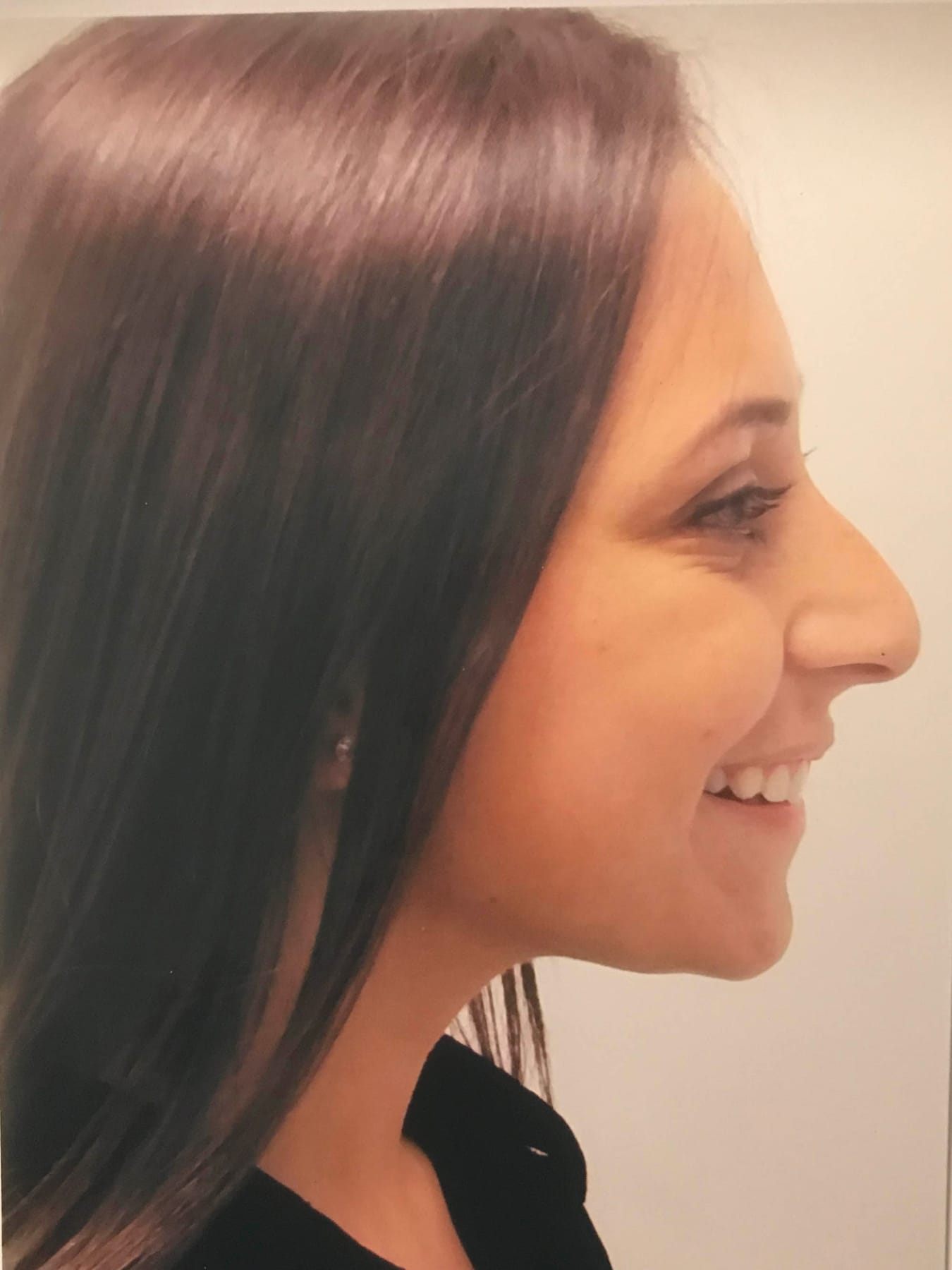Case Study 35 — before and after
