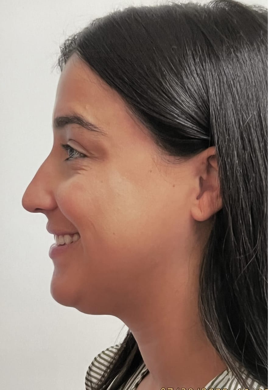 Case Study 150 before