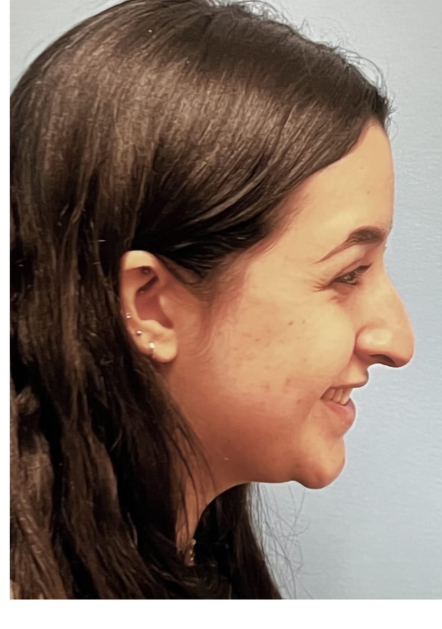 Case Study 141 — before and after