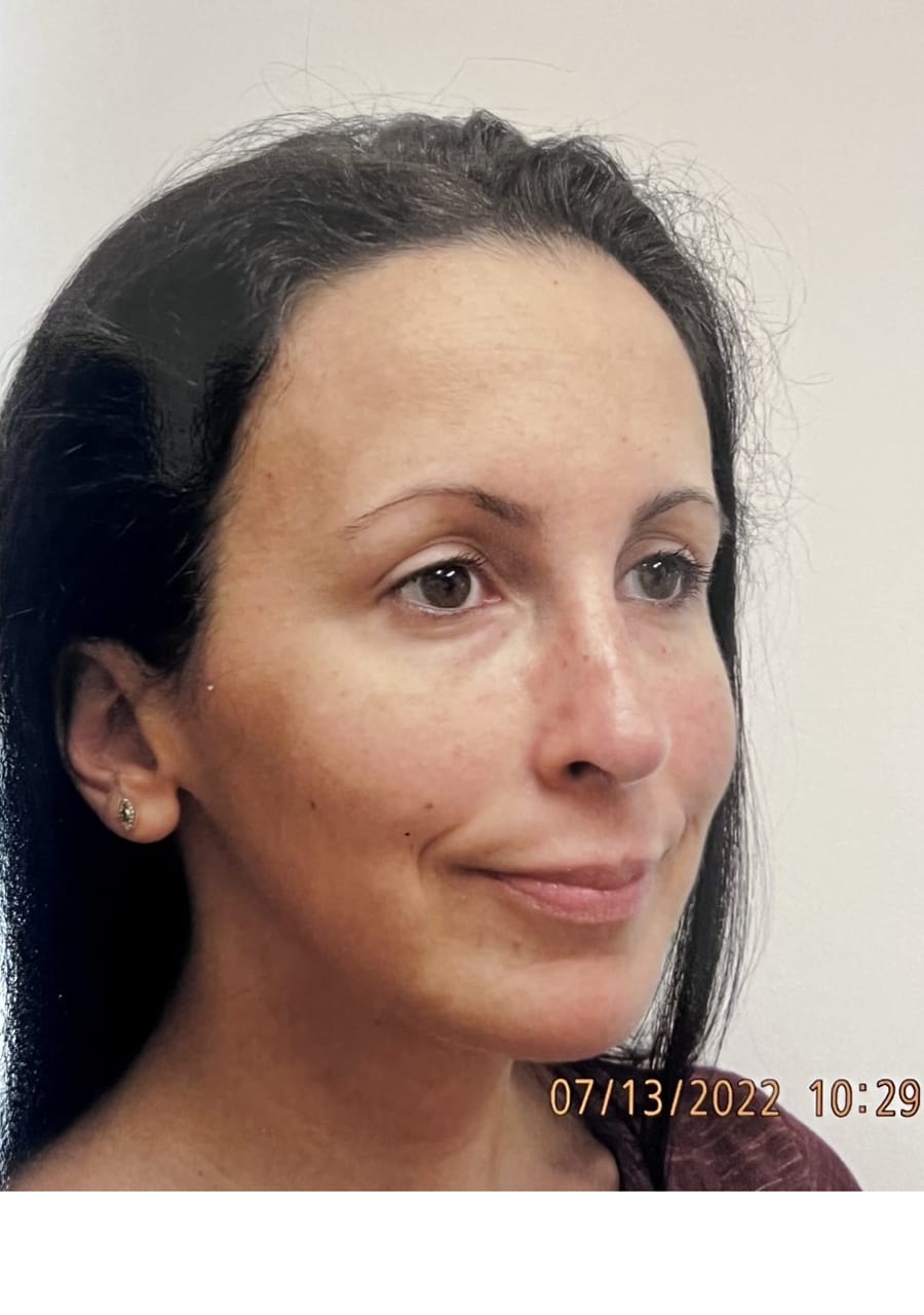 Case Study 64 after