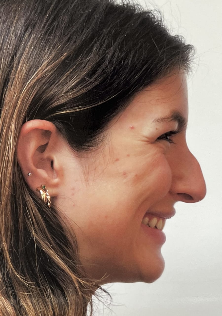 Case Study 113 — before and after