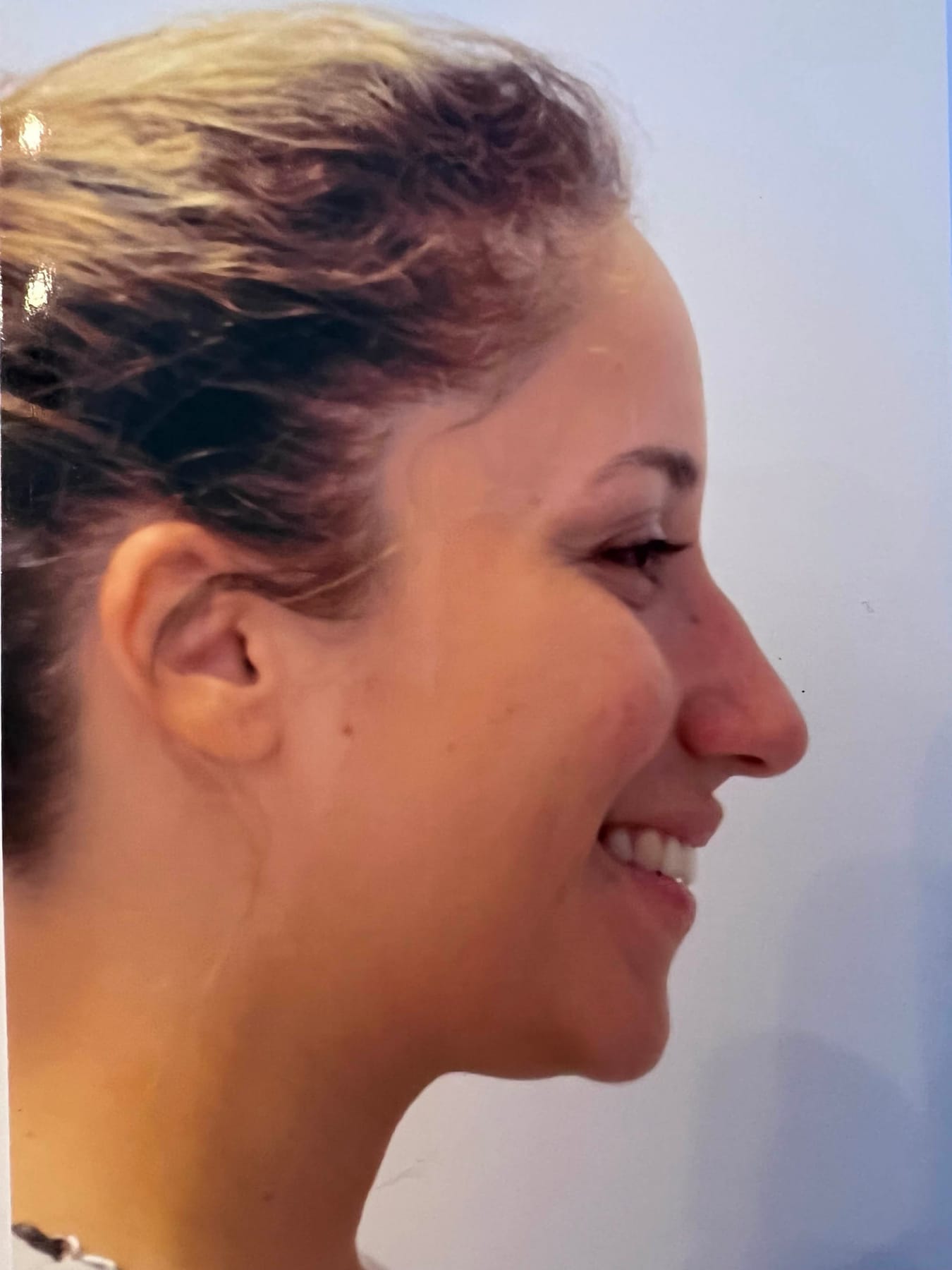 Case Study 24 — before and after
